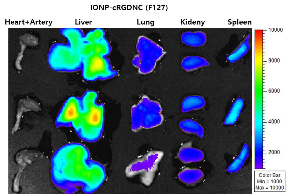 MR agent인 Iron oxide nanoparticle (IONP)를 포집한 혈관 내 플라그 표적화 나노입자의 장기별 분포도