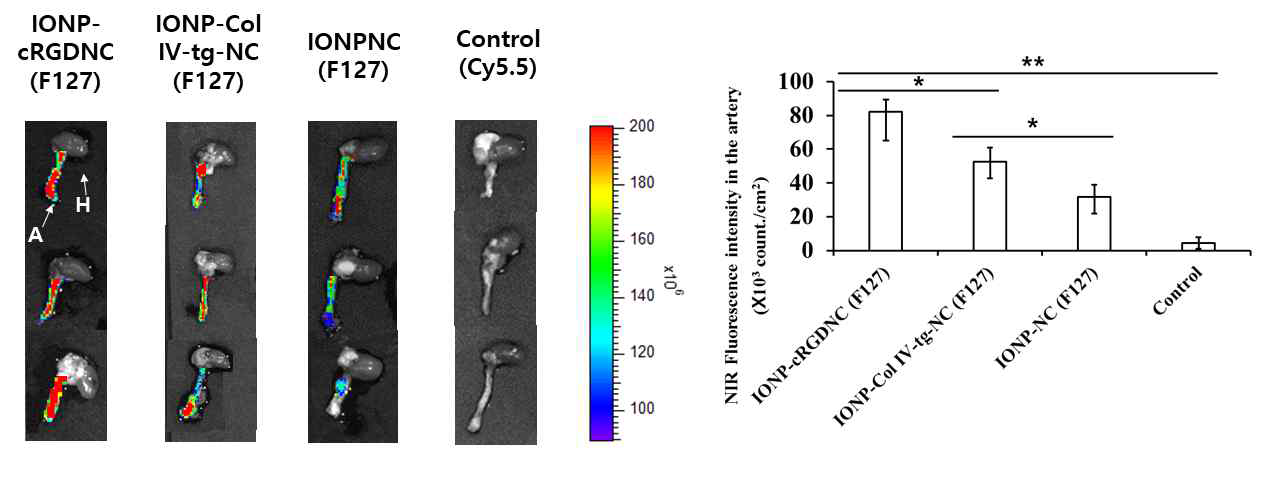 Iron oxide nanoparticle (IONP)를 도입한 F127 기반의 키토산 나노입자 및 리간드가 도입된 나노입자의 정맥 주입 24시간 뒤 플라그 형성된 혈관의 근적외선 이미지 및 그의 정량분석 결과 (p<0.05 is *, p<0.01 is **)