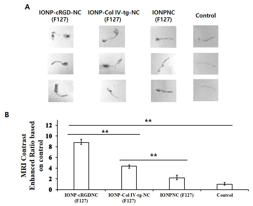(A) IONP가 포집된 나노 시스템의 정맥 주입 후 24시간 뒤 동맥 혈관의 자기공명 영상 이미지와 (B) 그의 정량 분석 결과 (** is p<0.01)