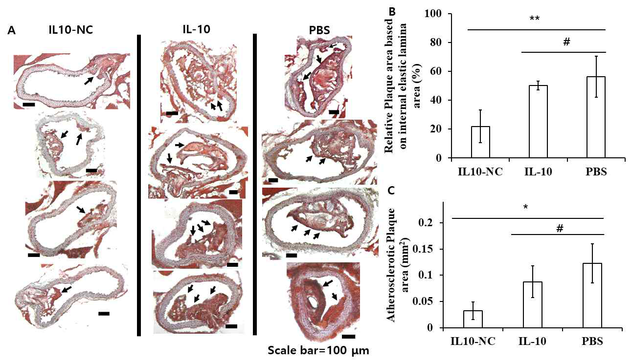 질환 동물 모델에 샘플 처리 후 혈관 내 플라그에 대한 (A) Oil red O 이미지와 그에 따른 (B) 상대적 (내관 크기에 비한 플라그 크기) 및 정량적인 플라그 크기 계산 결과 (#: p>0.05, *: p<0.05, **: p<0.01)