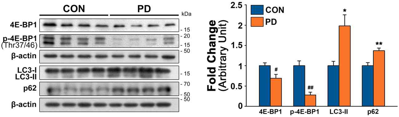 추가 확보한 정상대조군 및 파킨슨병 환자 사후 뇌조직 유래 단백질을 분석하여 신경영양인자 생성 및 세포 생존관여 핵심기전 활성 변화 확인. (좌) 파킨슨병 환자 사후 뇌조직에서 4E-BP1과 p-4E-BP1의 발현이 정상대조군에 비해 저해되어 있음. 파킨슨병 환자 사후 뇌조직에서 LC3-II와 P62 발현 수준이 정상대조군에 비해 증가되어 있음. (우) 웨스턴 블랏 결과를 통계 처리 후 그래프로 시각화