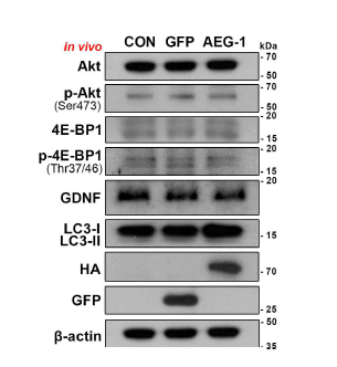 AAV 기반 유전자 구조물 도입 후 신경세포 생존 관련 주요 기전 활성 변화 확인 (2). 성체 마우스 흑질 내 AAV 기반 유전자 구조물 도입에 의한 신경세포 생존 관련 핵심기전인 Akt/mTORC1 기전의 활성도 변화 및 신경영양인자 발현 변화, 그리고 autophagy 신호 활성도 변화를 웨스턴 블랏을 이용하여 확인. 실험은 정상대조군(CON), GFP 도입군(GFP) 그리고 AEG-1 도입군(AEG-1)으로 나누어 진행됨. Akt, p-Akt, 4E-BP1, p-4E-BP1, 그리고 GDNF의 양적 변화 없음. Autophagy 신호 활성도 관찰 주요 인자인 LC3-I/-II 의 양적 변화 역시 관찰되지 않음