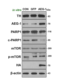 AAV 기반 유전자 구조물 도입 후 신경세포 생존 관련 주요 기전 활성 변화 확인 (3). 배양된 세포가 도파민성 신경세포임을 확인하기 위해, 해당 배양세포에서 도파민 신경세포 마커인 TH의 발현을 웨스턴 블랏을 통해 확인함. AEG-1이 도입된 세포를 구별하기 위해 AEG-1 인자 자체의 양적 변화 및 유전자 구조물 도입 후 발현시 나타나는 HA 발현을 확인함. PARP-1과 활성형인 c-PARP-1의 발현 변화를 확인함. mTOR 자체의 변화를 조사하였으며, mTOR의 활성형인 인산화된 mTOR (p-mTOR)의 양적 변화를 조사함