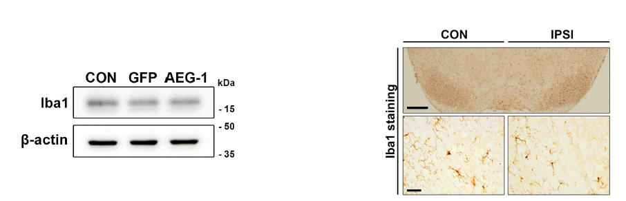 뇌염증 관련 핵심 세포인 미세아교세포 발현 및 활성도 변화 확인 성체 C57BL/6 마우스 흑질 내 유전자 구조물 도입 4주 후 뇌조직으로부터 단백질을 추출, 뇌염증 관련 핵심 세포인 미세아교세포의 양적 변화를 웨스턴 블랏 분석을 통해 정량적으로 분석하였으며, 미세아교세포의 활성 정도를 조직면역염색을 통해 분석함. (좌) AEG-1 도입에 의한 미세아교세포 표지자 단백질인 Iba1의 양적 변화는 나타나지 않음. Scale bar, 500 ㎛. (우) Iba1에 대한 조직면역염색 결과, AEG-1 도입에 의한 미세아교세포의 형태적 변화 관찰되지 않음. Scale bar, 50 ㎛