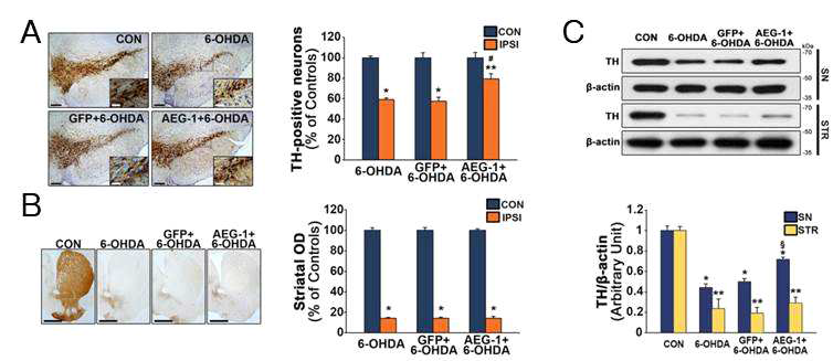 유전자 구조물 도입에 의한 도파민 신경세포 보호효과 확인 in vivo 성체 마우스 우측 중뇌 흑질 내 유전자 구조물 도입 3주 후 우측 대뇌 선조체 내에 신경독성물질인 6-Hydroxydopamine (6-OHDA)을 처리하여 일주일 뒤에 뇌를 적출, 조직면역염색 및 웨스턴 블랏을 통해 AEG-1 도입 유무에 따른 신경세포 생존 정도를 대조군과 비교 분석함. (A) 대표적인 TH 면역염색 결과(흑질)를 보여줌. 시계방향으로 정상대조군(CON), 6-OHDA 단독 투여군(6-OHDA), AEG-1 도입 후 6-OHDA 투여군(AEG-1+6-OHDA), GFP 도입 후 6-OHDA 투여군(GFP+6-OHDA). 6-OHDA 단독 투여군과 GFP 도입 후 6-OHDA 투여군 각각의 좌측 중뇌(Contralateral side)와 우측 중뇌 (Ipsilateral side) 비교 시, 두 그룹의 우측 중뇌 흑질에서 40 % 이상의 TH 양성 세포 소실이 관찰되었으나, 6-OHDA 투여군과 GFP 도입 후 6-OHDA 투여군의 우측 중뇌 내 TH 양성 세포수를 AEG-1 도입군의 우측 중뇌 흑질 내 TH 양성 세포수와 비교하였을 때, AEG-1 도입군에서 두 그룹에 비해 TH 양성 세포가 15 % 이상 더 보존되어 있음을 확인함. 오른쪽은 TH 양성 세포수를 그래프화 한 것임. Scale bar, 200 ㎛. (B) 성체 마우스 대뇌 선조체 부위에서 도파민 신경섬유 보존 정도를 분석하기 위해 TH 면역염색을 실시. 좌측은 조직면역염색 결과이며, 우측은 분석 결과를 그래프화 한 것임. 좌측부터 순서대로 정상대조군(CON), 6-OHDA 단독 투여군(6-OHDA), GFP 도입 후 6-OHDA 투여군(GFP+6-OHDA), AEG-1 도입 후 6-OHDA 투여군(AEG-1+6-OHDA). 6-OHDA가 투여된 모든 그룹에서 비슷한 정도의 TH 양성 신경섬유가 관찰됨. Scale bar, 1,000 ㎛. (C) 웨스턴 블랏 결과, 조직면역염색과 같은 결과가 도출됨