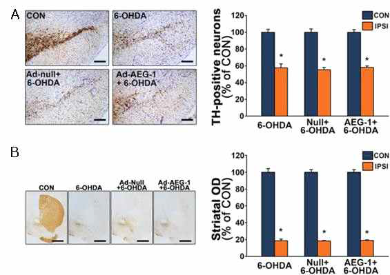 제작한 AV 기반 유전자 구조물 선주입 후 파킨슨병 동물모델에서 AV-AEG-1에 의한 도파민 신경 시스템 보호효과 확인. (A  1,000㎛ (B)