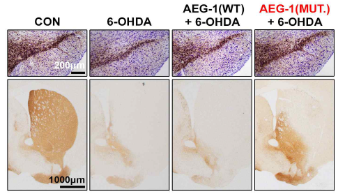 조직면역염색을 통한 신규 유전자 구조물의 도파민 신경 시스템 보호효과 확인 신규 유전자 구조물(mutant AEG-1) 도입에 의한 성체 마우스 중뇌 흑질 도파민 신경세포 및 대뇌 선조체 도파민 신경섬유 보호효과 확인. 이는 기존 AEG-1(WT) 도입에 의한 도파민 신경세포 보호효과보다 개선되었음을 알 수 있음