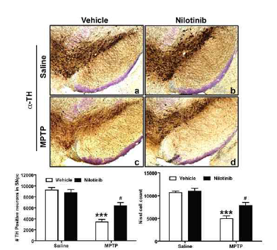 Nilotinib의 도파민 신경세포 보호효과 Karuppagounder et al., 2014 Sci. Rep