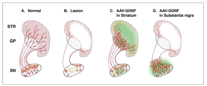 AAV-GDNF에 의한 신경보호효과 Björklund et al., 2000 Brain Res