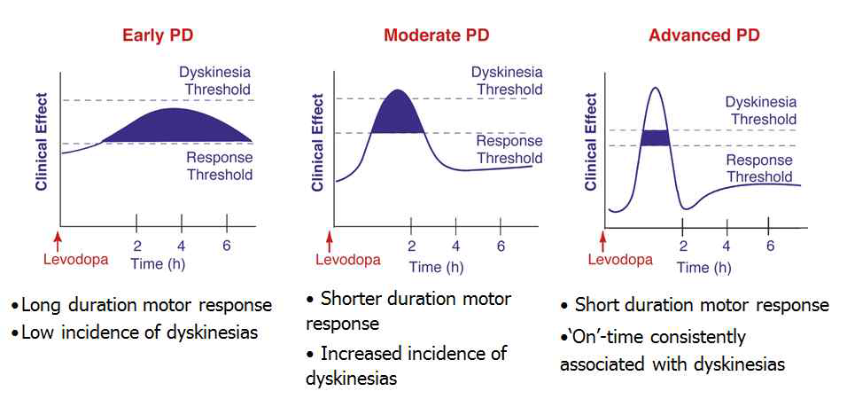 파킨슨병 단계에 따른 레보도파 효능 변화 파킨슨병이 진행됨에 따라 레보도파의 치료 반응 영역이 감소되어 약물의 작용 시간이 짧아지고 운동이상 (dyskinesia)과 같은 부작용이 발생함. (Olanow et al., 2001 Neurology)