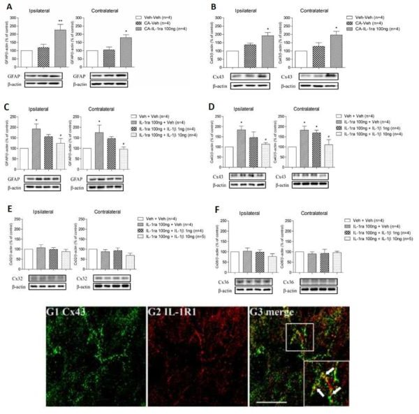 (A) IL-1ra 처치 척수 GFAP 발현 양상 western blot 분석 비교. (B) IL-1ra 처치 척수 Cx43 발현 양상 western blot 분석 비교. (C) IL-1β와 IL-1ra 동시 처치 시 척수 GFAP의 발현 양상 western blot 분석 비교. (D) IL-1β와 IL-1ra 동시 처치 시 척수 Cx43의 발현 양상 western blot 분석 비교. (E) IL-1β와 IL-1ra 동시 처치 시 척수 Cx32의 발현 양상 western blot 분석 비교. (F) IL-1β와 IL-1ra 동시 처치 시 척수 Cx36의 발현 양상 western blot 분석 비교. (G) Cx43과 IL-1R1의 동시 발현 현미경 사진