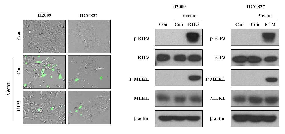 세포내에서 RIP3 발현 확인 및 necroptosis 관련 단백질 변화