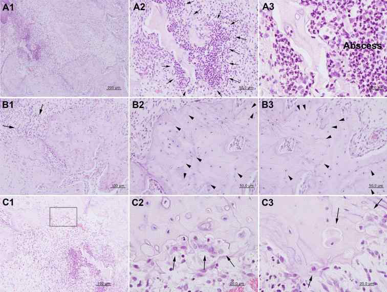 Histological findings with 18 Gy irradiation showing more dead bone than the bones irradiated with 16 Gy dose and the presence of resorption with osteoclast cells. The abscess (A1, A2, A3; arrow), inflammatory infiltrate (B1; arrow) and empty osteocytic lacunae (B2, B3; arrow head) were observed. The close-up of box in the C1 was magnified as C2. There are numerous osteoclast cells was observed in radionecrotic lesions border line. A1, A2 arrow, A3: abscess and abscess border line; B1 arrow: inflammatory cell; B2, B3 arrow head: empty osteocytic lacunae; C1,C2 arrow: osteoclast cells C3: internal osteoclast cells. A1,A2: resorption line; A3 arrow: inflammatory cell; B1,B2,B3 arrow head: empty osteocytic lacunae; C1,C2,C3 arrow: osteoclast cells; C3 arrow head: dead bone border line