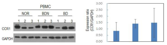 Total expression of CCR1 in PBMC of normal, BDN (asymptomatic), and BD (symptomatic) mice analyzed by Western blotting (n=3) and expression ratio compared to GAPDH (n=7)