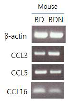CCR1 ligands RT-PCR in PBMC of normal mice