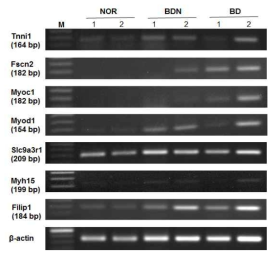 RT-PCR for actin filament related genes in peripheral blood leukocytes of normal, BDN, BD mice
