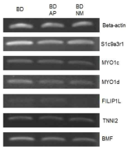RT-PCR for actin filament related genes in peripheral blood leukocytes of BD mice after treated with AP or NM