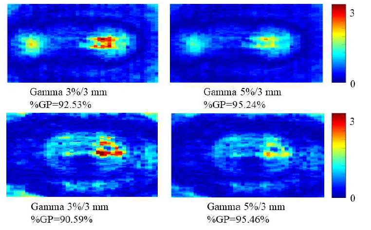 인체모사 팬톰 내 직장 윗부분의 필름 선량 측정값과 계산 결과 값의 gamma evaluation distribution; 위) 3 cm applicator 인체모사 팬톰, 아래) 4 cm applicator 인체모사 팬톰