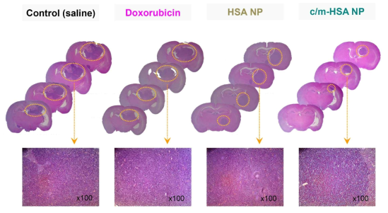 U87MG 종양유도된 마우스 뇌의 H&E 조직학적 소견 (식염수 및 doxorubicin solution, HSA NP, and c/m-HSA NP)