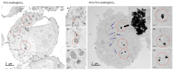 RVG-PEG-AuNRs@SiO2, PEG-AuNRs@SiO2의 세포 내 흡수를 나타내는 TEM 이미지