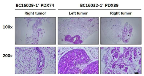 H&E 염색을 통한 BC16029와 BC16032의 종양 확인