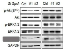 Gpr-A 과발현 위암세포주에서의 knock-down 에 의한 신호전달체계 억제 효과