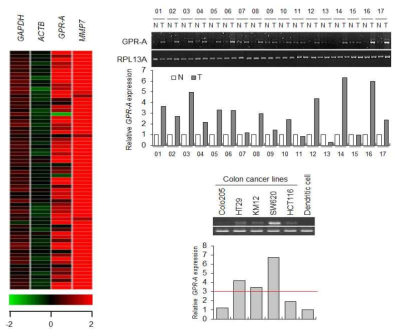 대장암 조직과 세포주에서 Gpr-A의 RNA를 확인