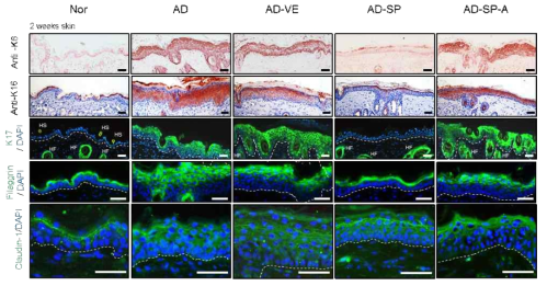 면역 염색을 통하여 SP에 의한 피부 특이 마커들의 정상 발현 확인