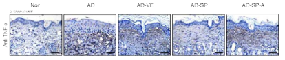 SP 도포를 통한 피부 내 염증 (TNF-α) 감소
