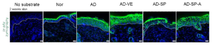 in situ zymograpy를 통한 피부 내 gelatinase 활성 평가