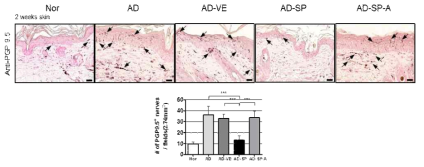 면역 염색을 통한 SP 적용 피부 내 침투된 감각 신경 (PGP9.5) 의 감소 확인