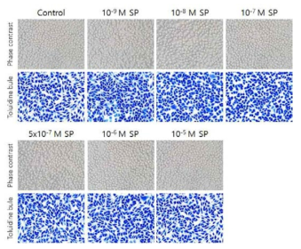 SP 농도에 따른 RBL-2H3 세포 변화 및 탈과립 여부 검증