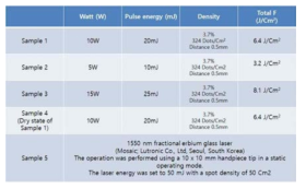 laser 강도 및 실험 조건