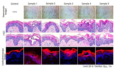 laser 처리 조건 별 돼지 피부 표면의 상처와 깊이에 따른 SP-5’-TAMRA이 투과성 증대