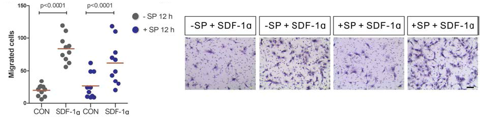 SDF-1 처리에 따른 ST2 세포의 이동 증진 효과는 SP 전처리에 의해 조절되지 않음