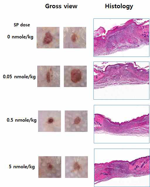 SP용량별 손상 조직 비교분석