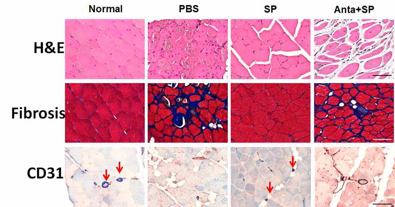 하지 허혈 질환에서 SP투여에 따른 근육 내 섬유화 분석 (MTC) 및 혈관 형성 분석