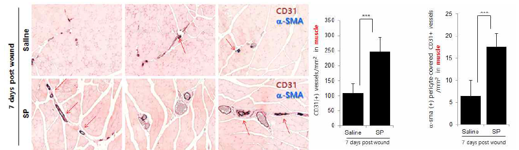 허혈성 궤양 모델에서 근육 조직 내 모세 혈관 및 A-SMA-covered perivascular zone분석 (조직 염색)