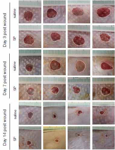 Diabetic ulcer 모델에서 시간에 따른 wound size 감소