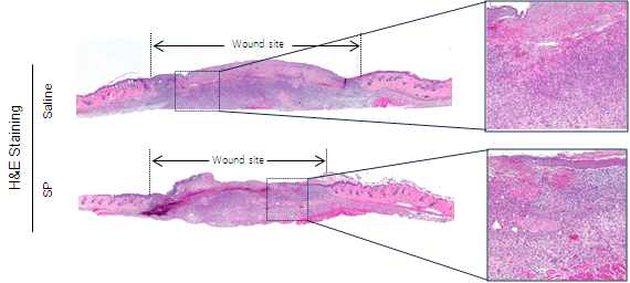 diabetic ulcer 조직 분석 (H&E staining)