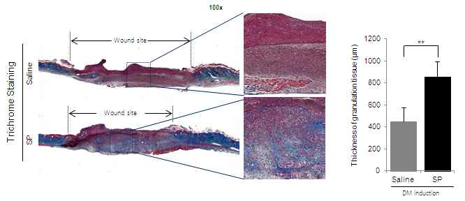 콜라겐 합성 정도를 조직학적 분석 및 Granulation tissue 두께 정량