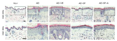 조직학적 분석을 통한 SP에 의한 표피 이상 증식 억제 확인