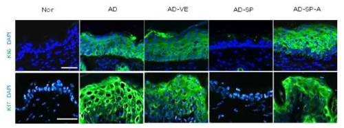면역 형광 염색 방법을 통한 이상 증식 표지자인 Keratin 6, Keratin 17이 SP 처리군에서는 감소된 발현 확인