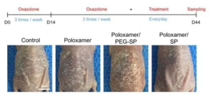 Poloxamer 하이드로젤 기반 SP 서방형 전달 모식도 및 아토피 치료효능 분석 (44일)