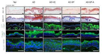 면역 염색을 통하여 SP에 의한 피부 특이 마커들의 정상 발현 확인