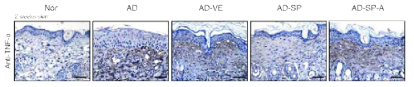 SP 도포를 통한 피부 내 염증 (TNF-α) 감소