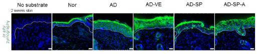 in situ zymograpy를 통한 피부 내 gelatinase 활성 평가