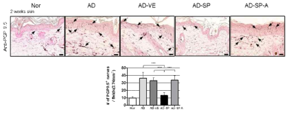 면역 염색을 통한 SP 적용 피부 내 침투된 감각 신경 (PGP9.5) 의 감소 확인