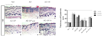 조직학적 분석을 통한 Palmitic acid conjugated SP의 아토피피부염 피부 개선 효과 확인