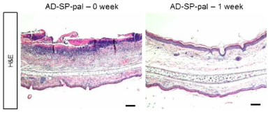 조직학적 분석을 통한 Palmitic acid conjugated SP의 아토피피부염 귀 피부 개선 효과 확인